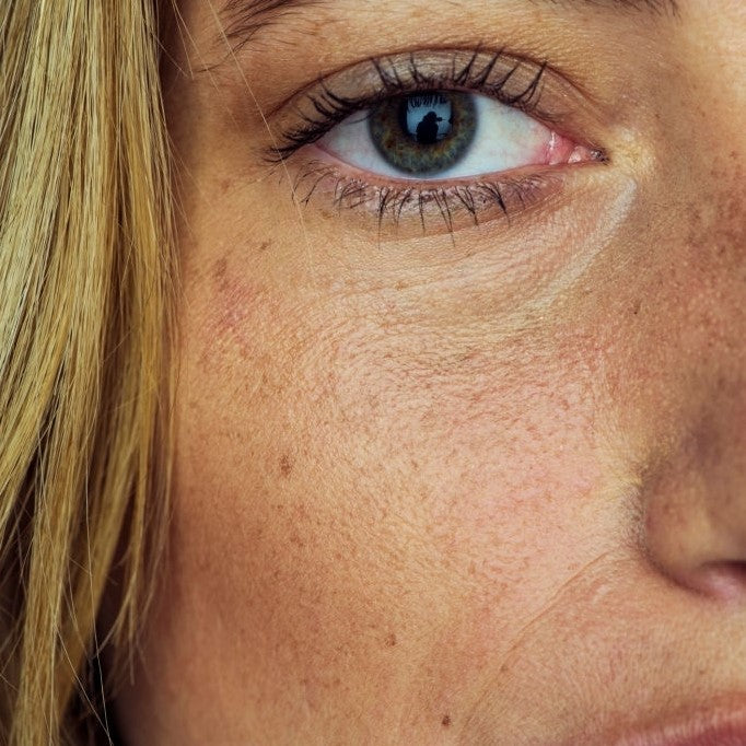 Unveiling My 3 Skincare Struggles...